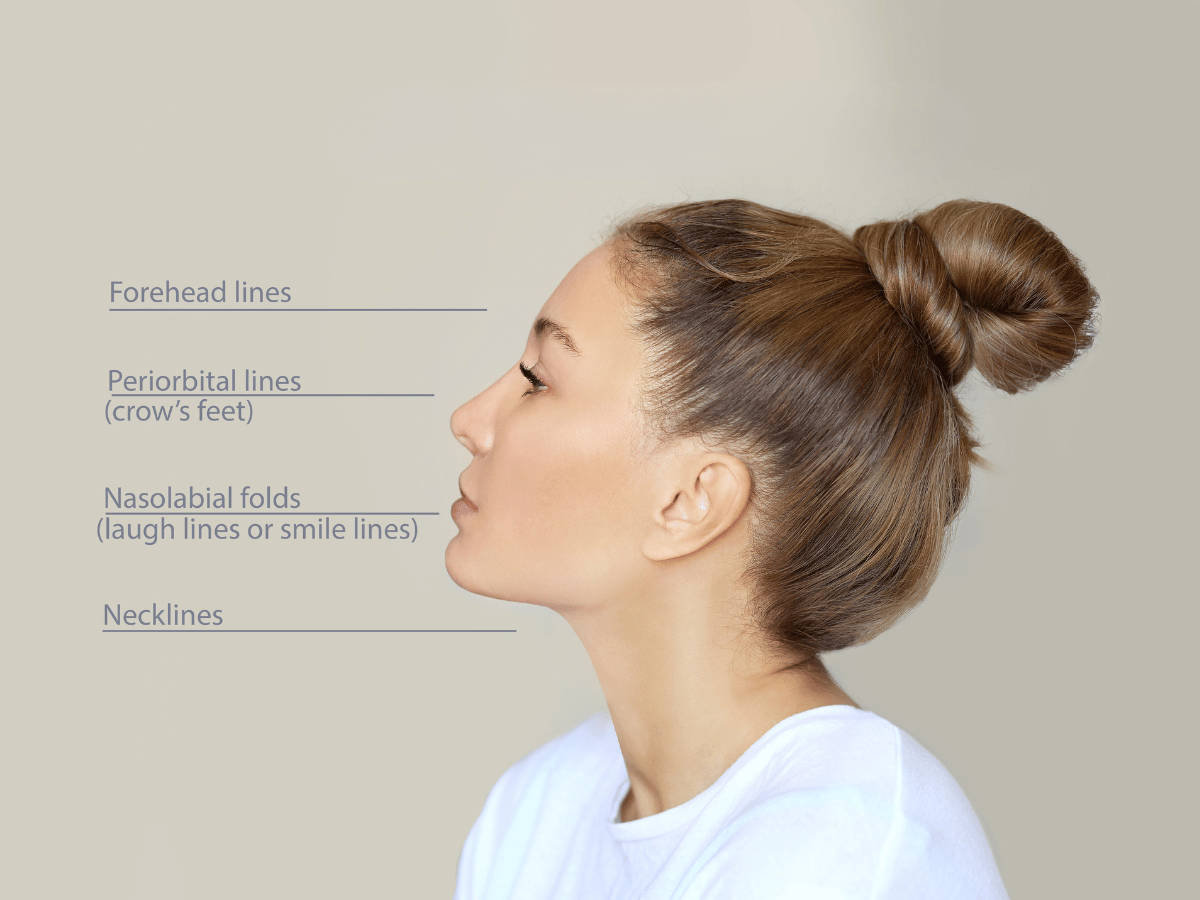 Explaining different characteristics of dermal filler effects using a lady's face