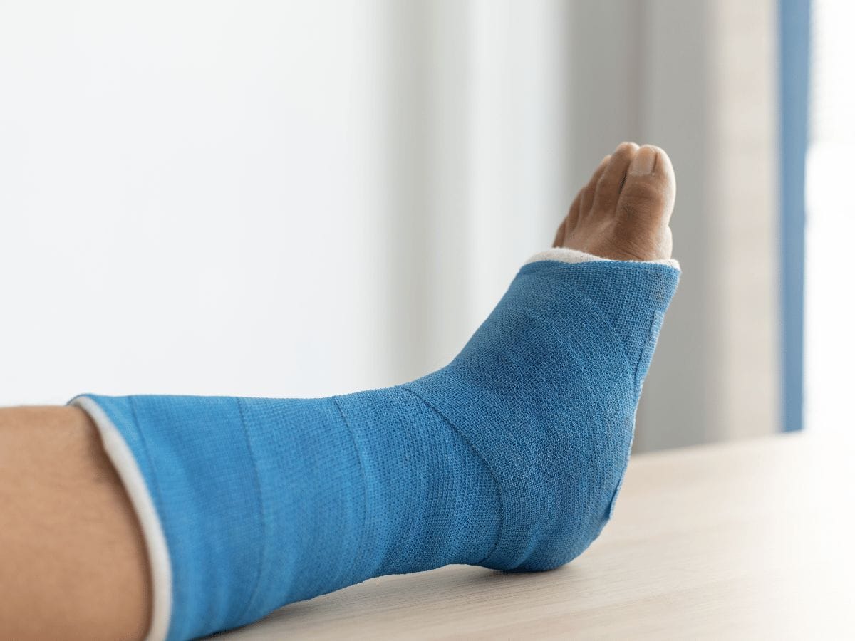 a patient with ankle fracture