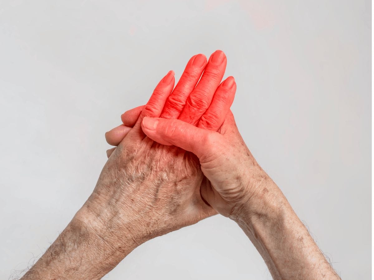 gout inflamed joints