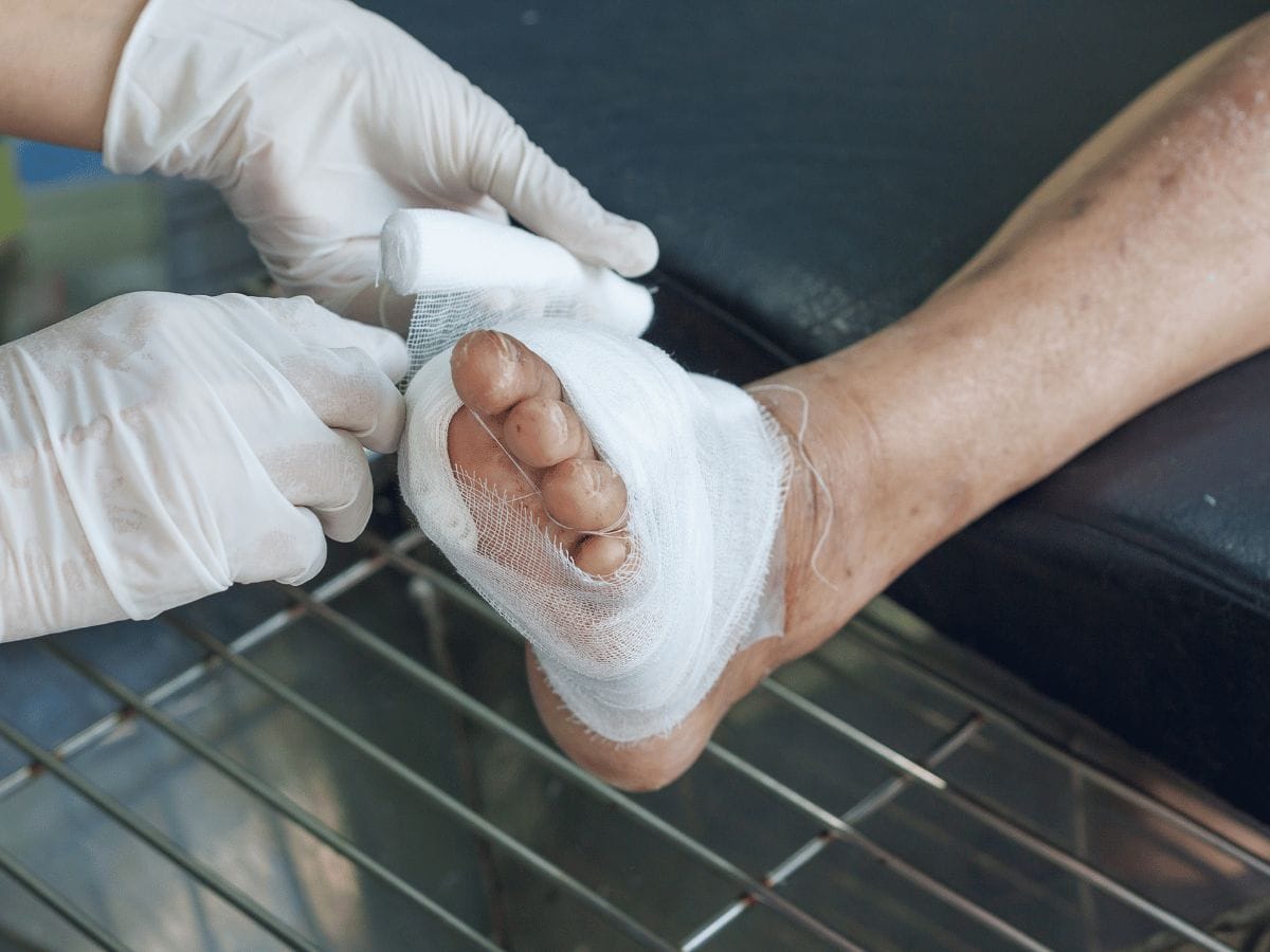 patient's leg with forefoot disorder