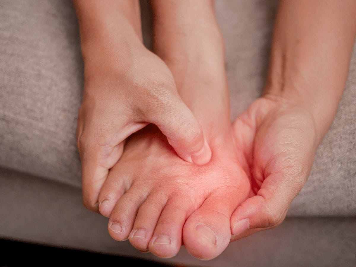 patient's leg with bunion deformity