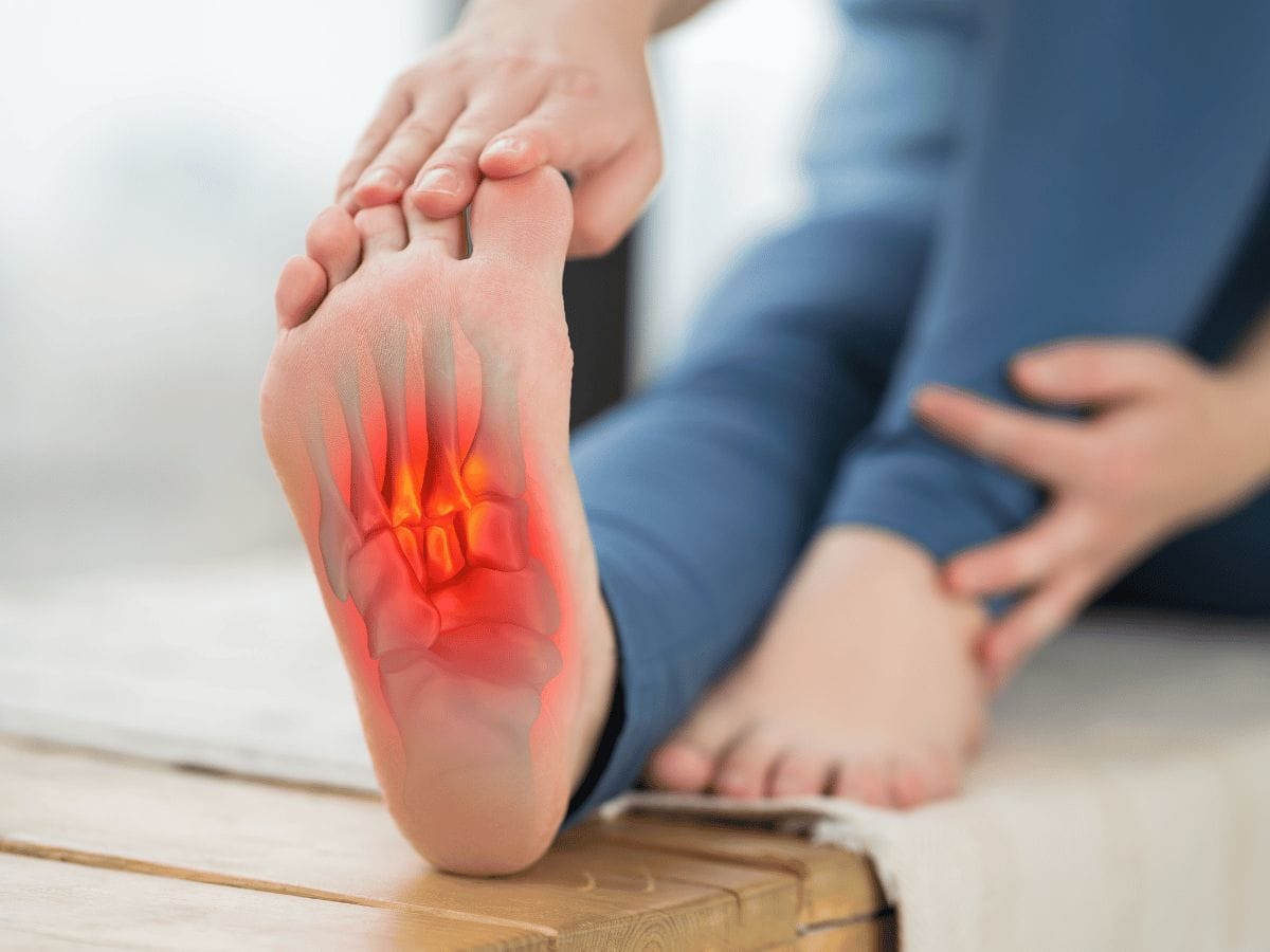 a patient's foot effected by plantar fasciitis