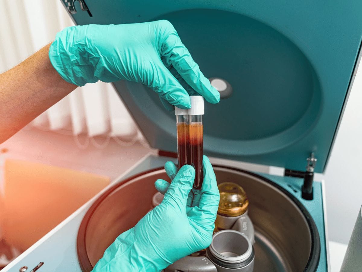 platelet rich plasma preparation with blood transfusion