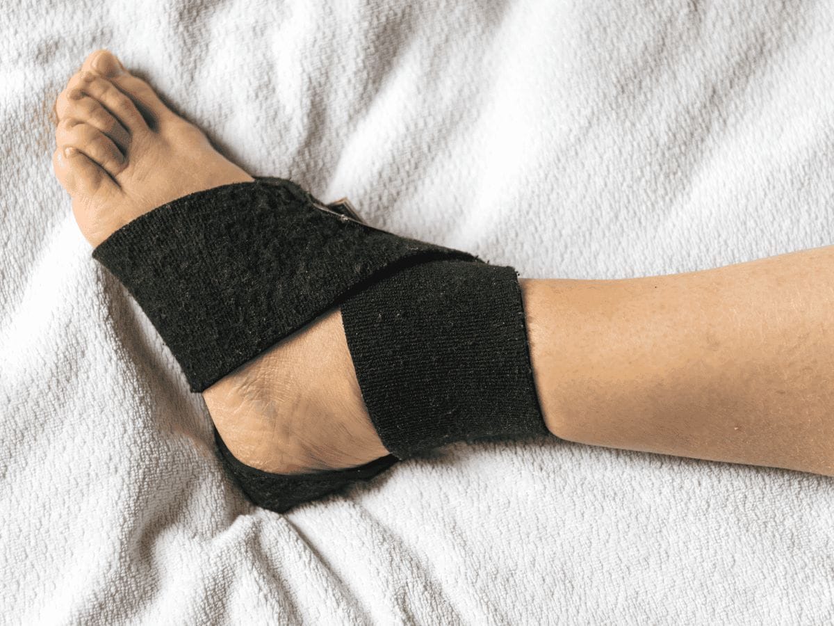 patient's foot affected by ankle sprain