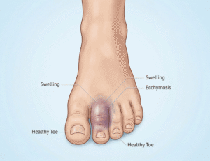 Image showing a close up of a toe